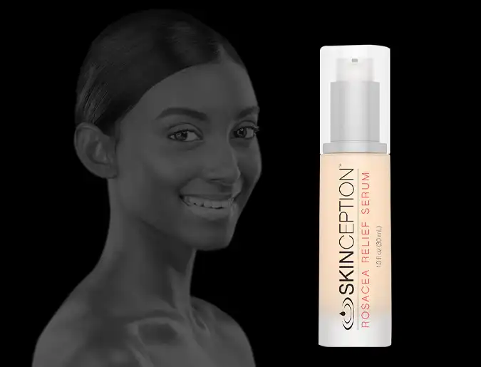 Skinception Rosacea Treatment Reviews – Should You Trust This Product?